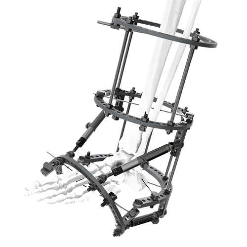 trueLok-charcot